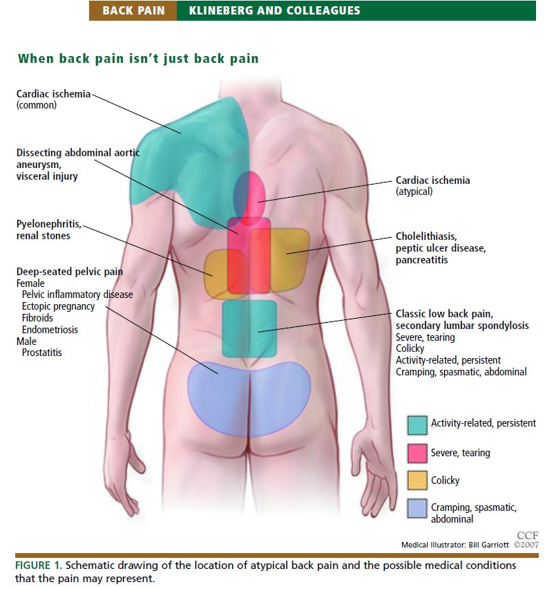 gallbladder-pain-shoulder-blade-sexiz-pix